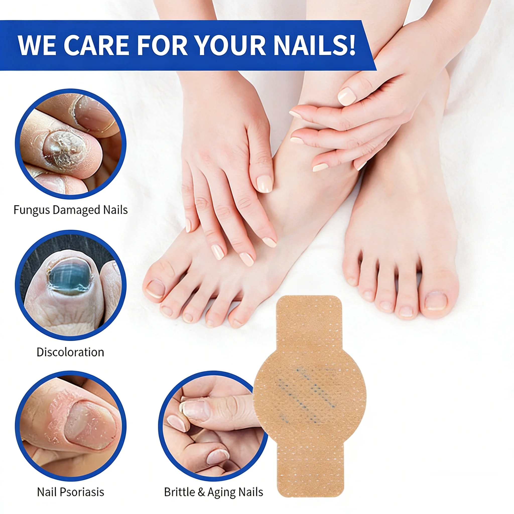 Ingrown Toenail Correction Patch Waterproof Nail Repair Tool Set_voghion.com
