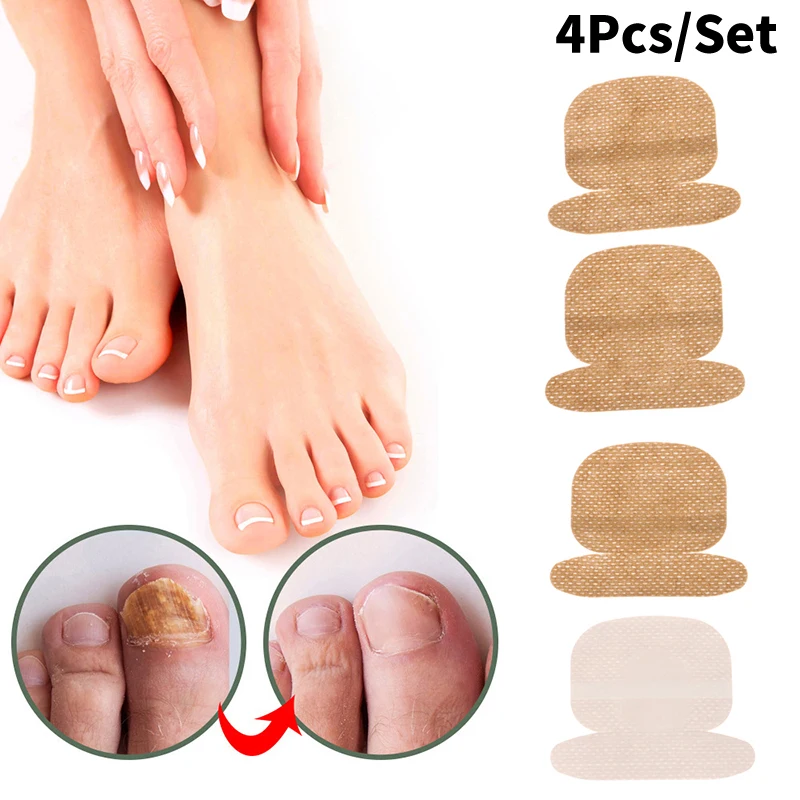 

4Pcs Onychomycosis Treatment Patch Anti Infection Paronychia Correction Sticker