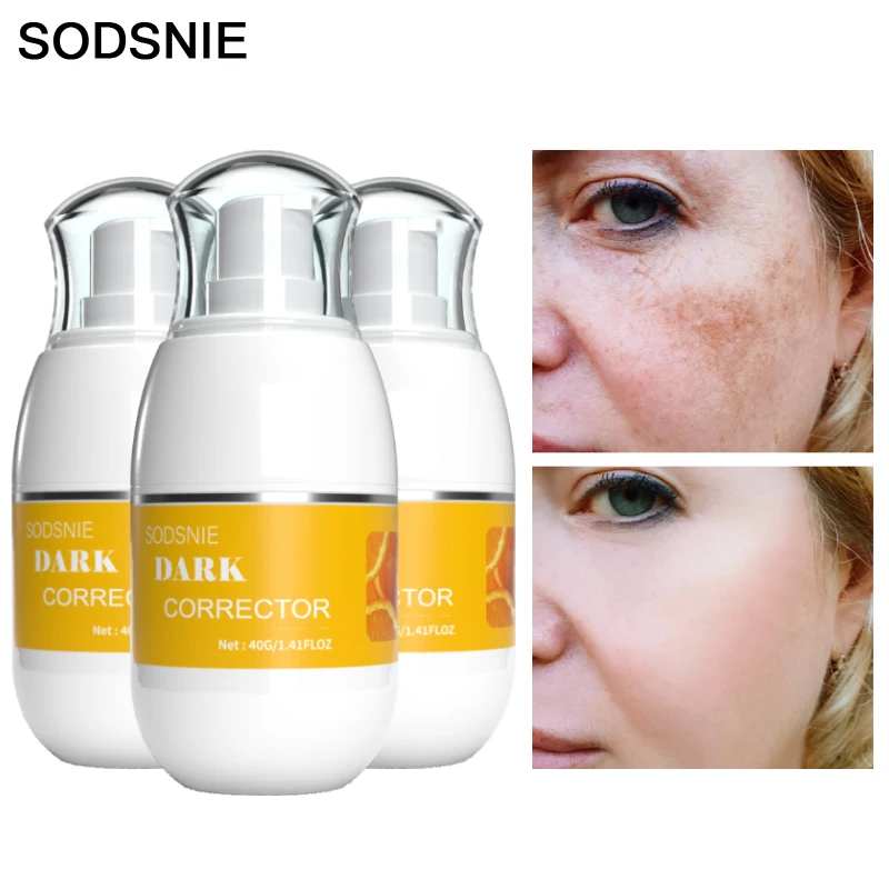 Dark Spot Corrector Cream Skin Whitening Brightening Fade Spots Removing Melasma Pigmentation Moisturizing Beauty 40g * 3pcs