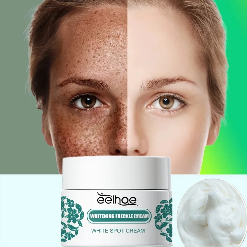 Niacinamide Face Melasma Brighten Cream Reduce Melanin Chloasma Stain Corrector Dark Skin Brighten Emulsion Moisturize Skin Care