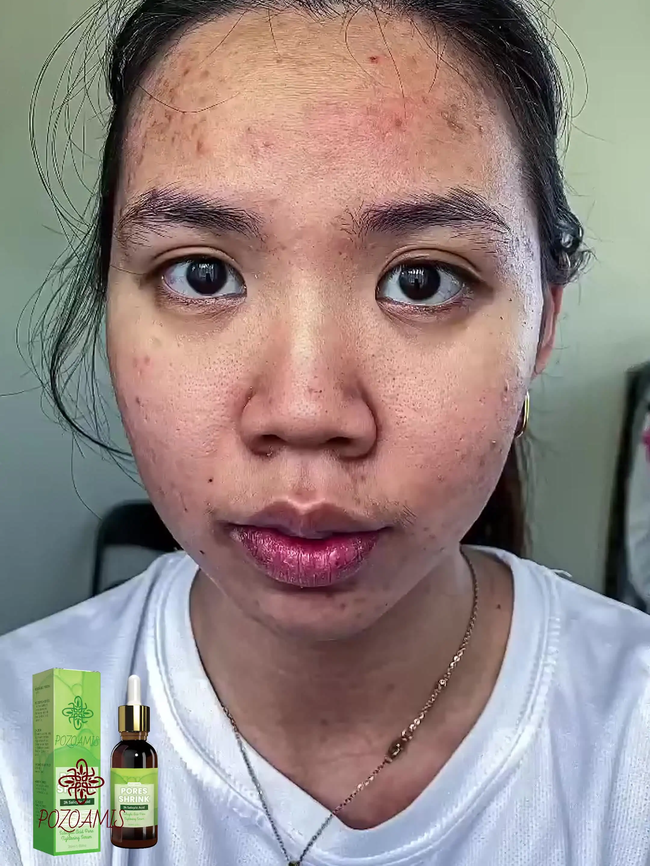 Салициловая кислота сыворотка для лица NoEnName_Null | AliExpress