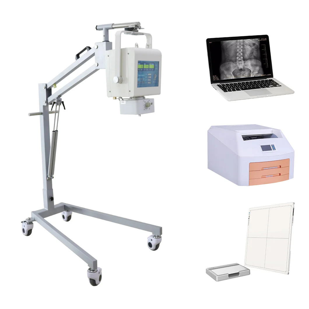 TouchScreenCheapXrayDigital5KWRadiographyPortableXRayMachine