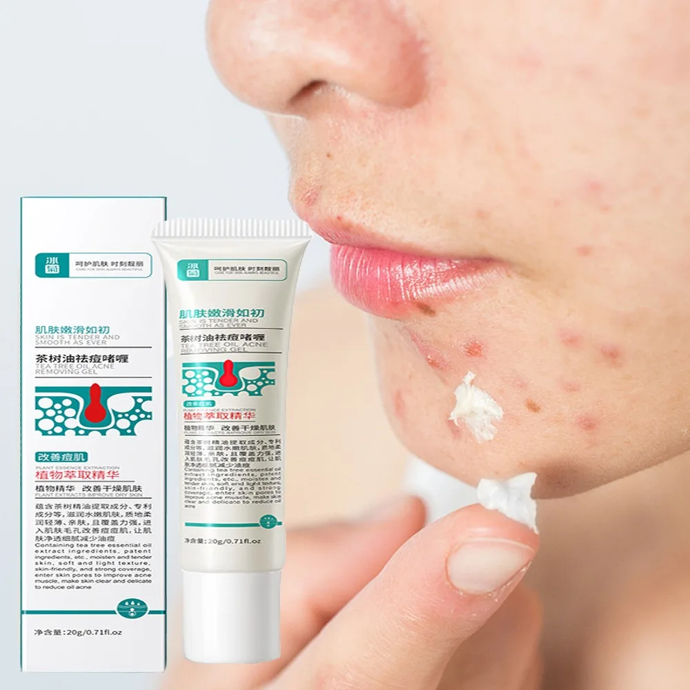 

Effective Acne Removal Cream Treatment Acne Scar Shrink Pores Oil Control Whitening Moisturize Face Skin Care