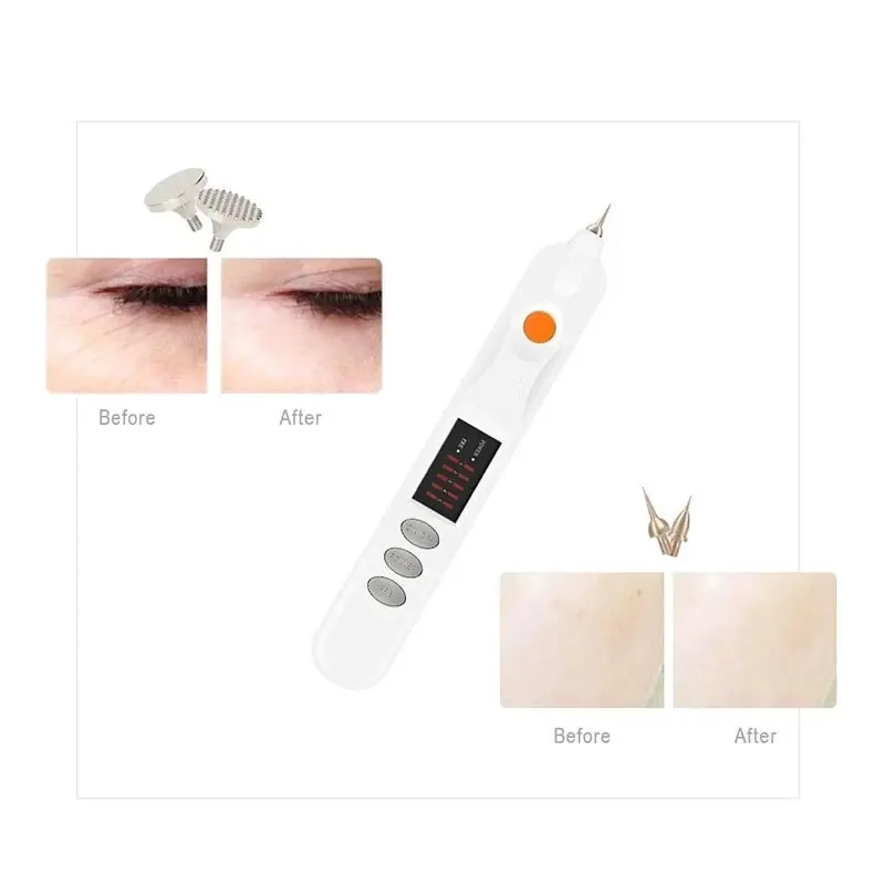 Plasma Pen Skin Mole Freckle Facial Wart Label Tattoo Removal Blackhead Beauty Care Tool blackhead remover skin tag removal tool skin tag removal pen