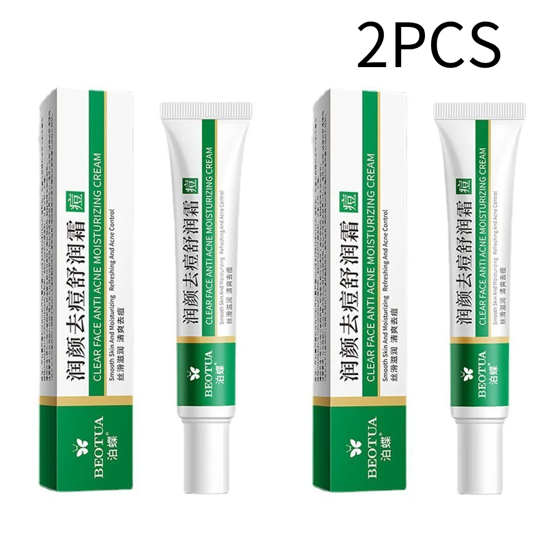 كريم ترطيب لإزالة حب الشباب ينظف ويزيل حب الشباب و...