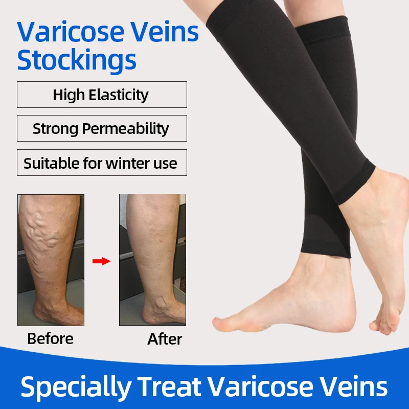 Prevent Calf Varicose Veins Compression Sock Medical Grade One Pressure  Treat Varicose Leg Women Slim Socks Black Flesh-colored - AliExpress