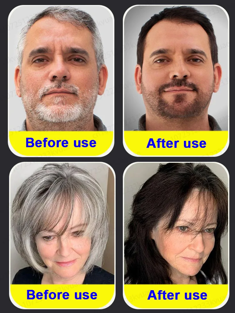 Hair Color Restorer White Hair Killer Used to turn white hair into black hair Nourish the scalp Suitable for white hair essence Repair care