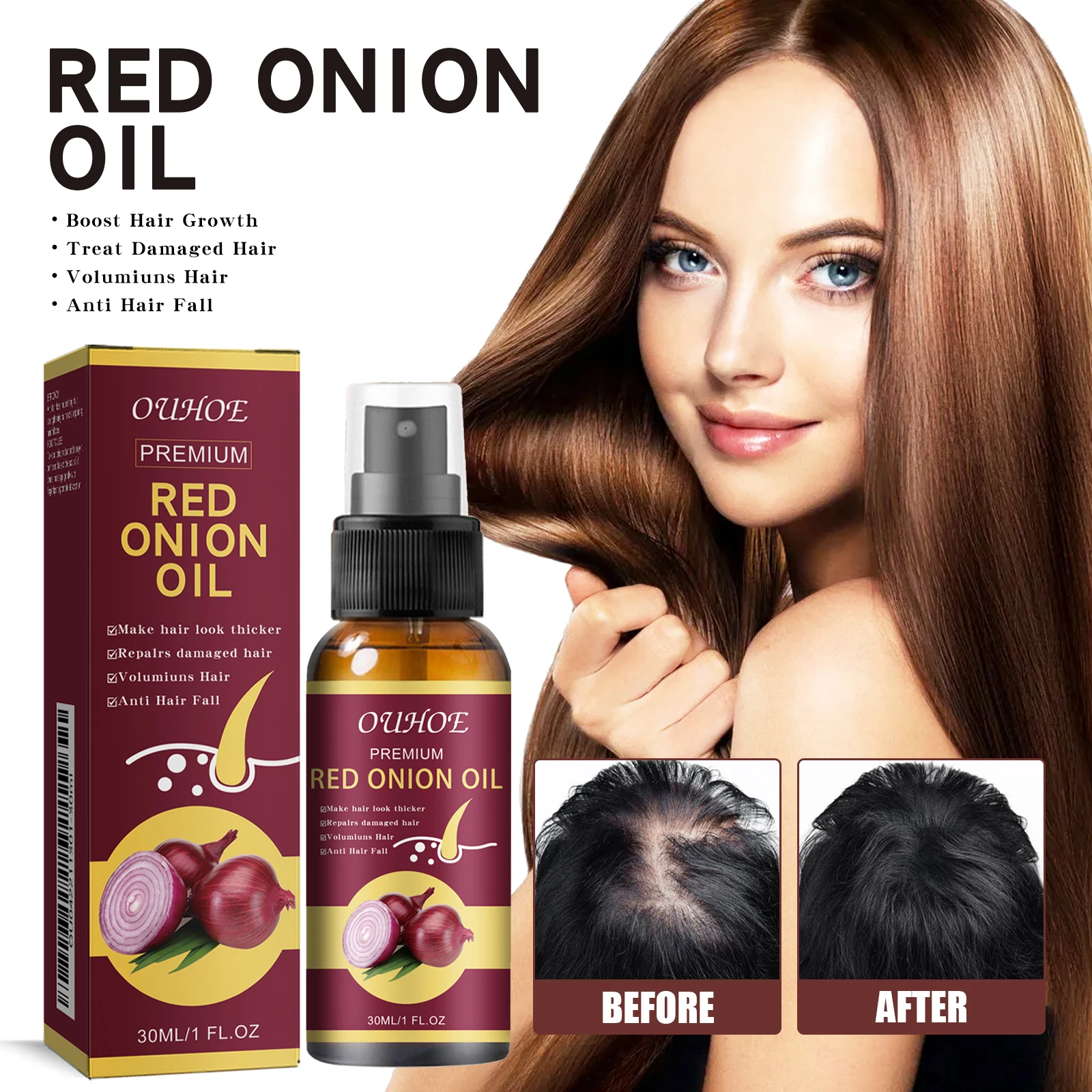 Red Onion Hair Growth Essential Oil Hair Care Spray Prevent Hair Loss ...