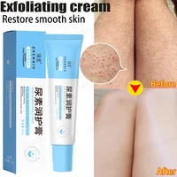 New Chicken Skin Repair Cream Curing Keratosis Follicle Pilaris Remove Thick Pores Body Dark Spot Moisturize Smooth Skin Care 1