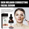 Melanin Correcting Face Serum Fade Dark Spots Brightening Melasma Chloasma Removal Reduce Pigmentation Whitening Freckle Essence 3