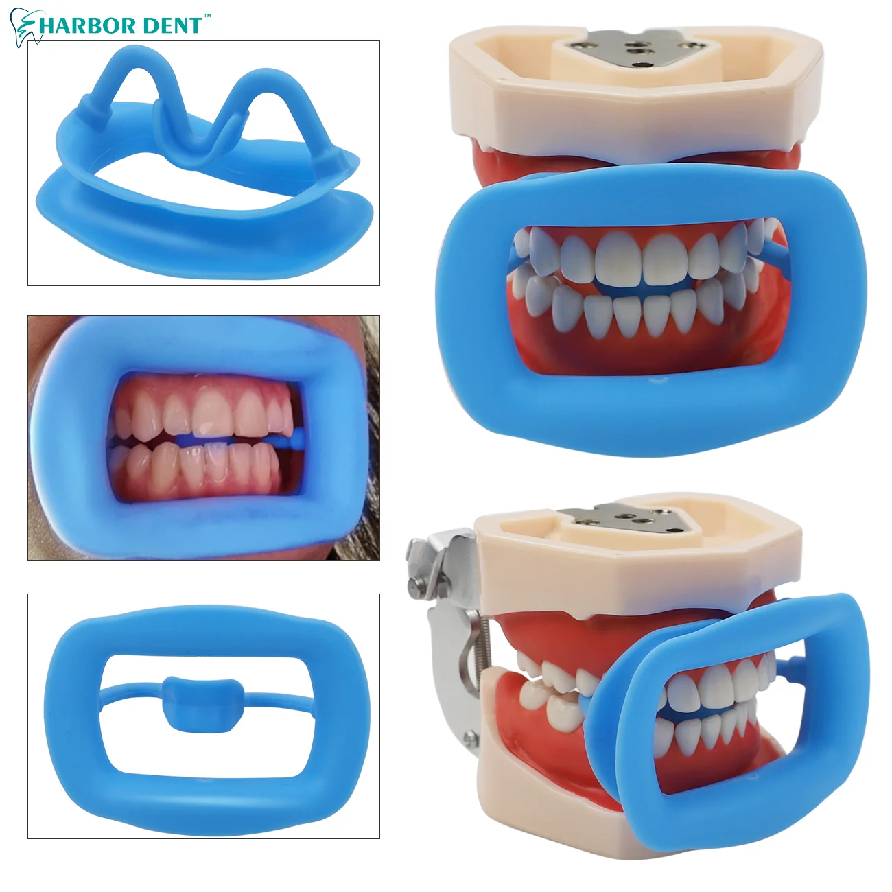 セルフホワイトニング用 マウスオープナー 200個セット 開口器