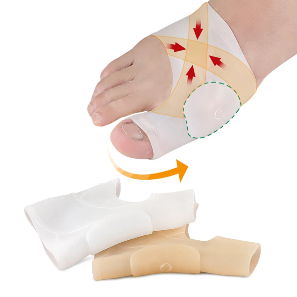 Separador de dedos de los pies de silicona, ajustador de ectropión de juanete, dispositivo exterior, Corrector de Hallux Valgus, herramientas para el cuidado de los pies, 1 a 10 piezas