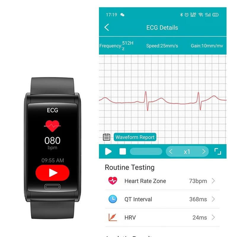 2020 ο ECG + PPG   ڵ  ǰ Ʈ ġ  ƮϽ ƮĿ smartwatch