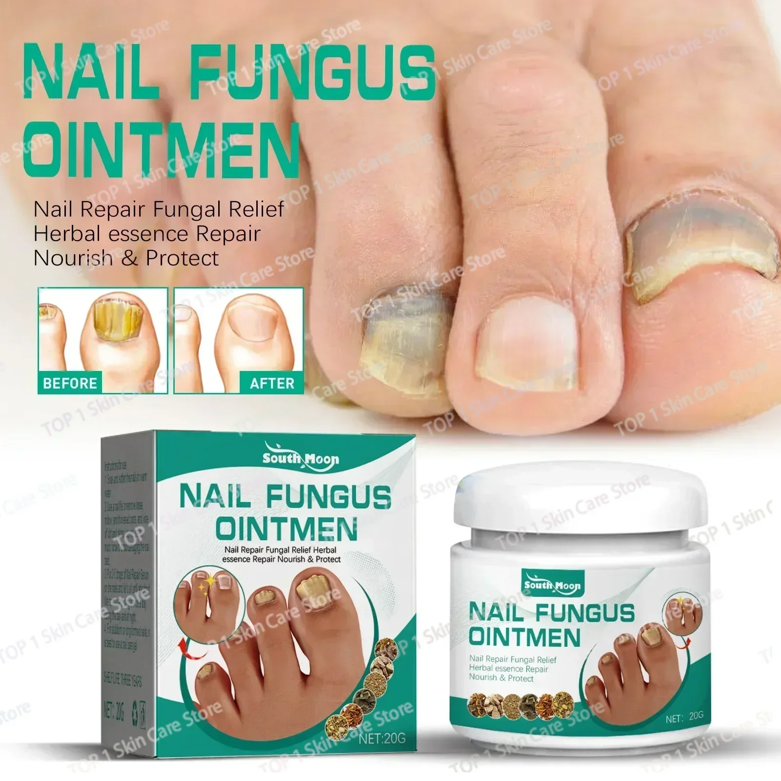 Fungal Nail Treatment Oil Foot Repair Essence Toe Nail Fungus Removal Gel Anti Infection Cream Fungal Removal