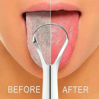 Tongue Scraper 1