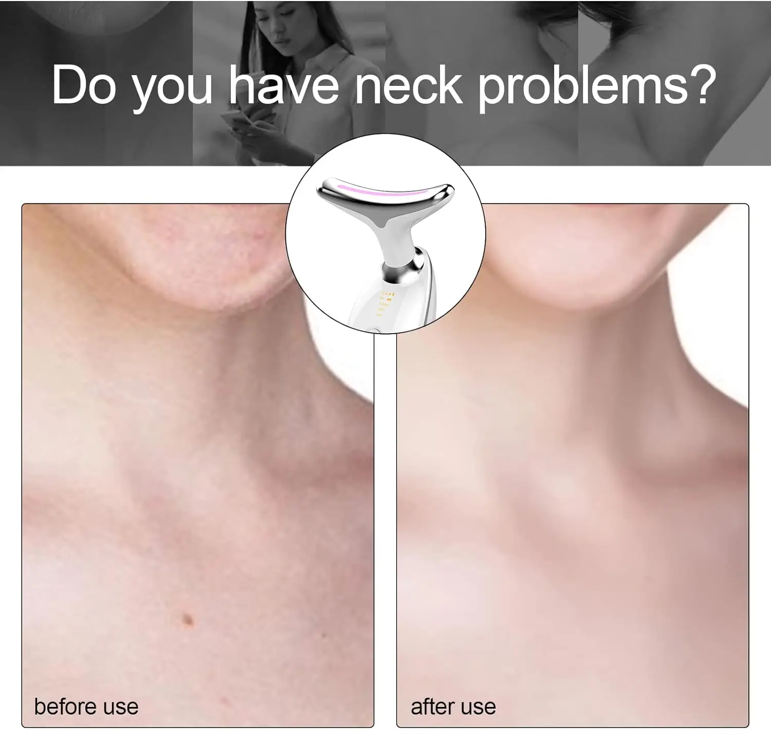 USB Facial Rejuvenation and Lifting Device for Enhanced Beauty and Skin Tightening