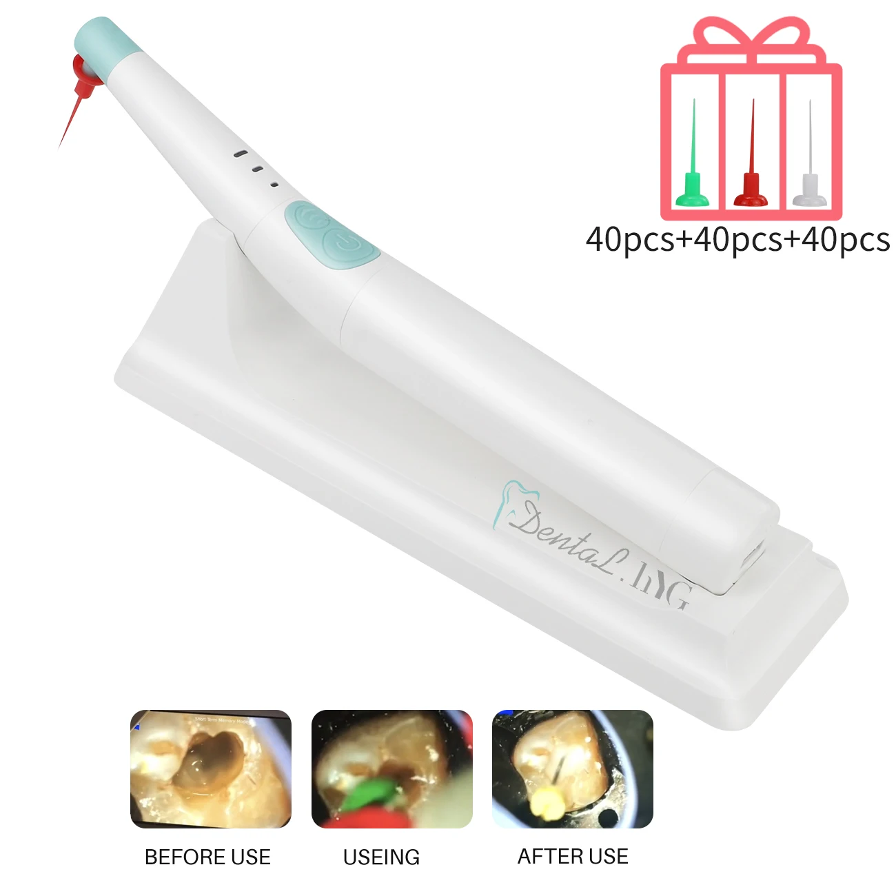 Cordless Dental Teeth Cleaning Equipment Endo Activator 3 speed Sonic