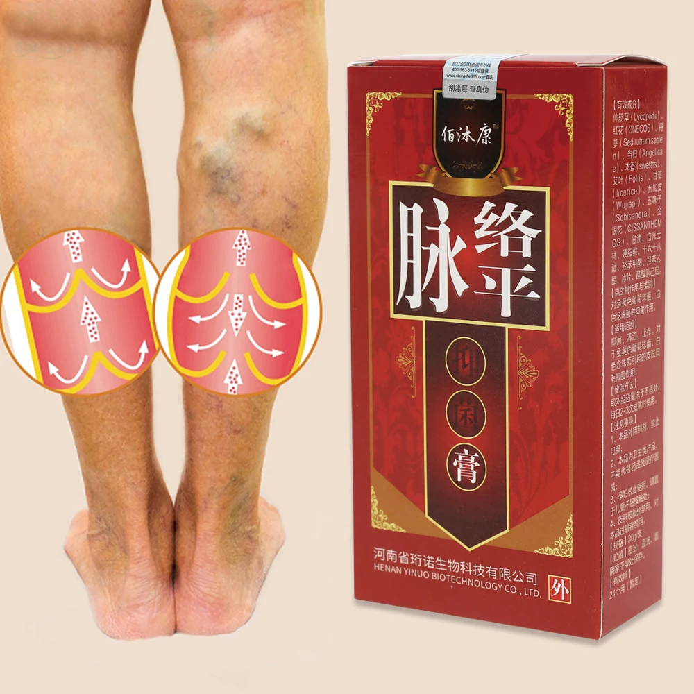 

Varicose Veins Treatment Cream Varicosity Angiitis Remedy Ointment Relief Veins Pain Phlebitis legs Varicose Veins Cream