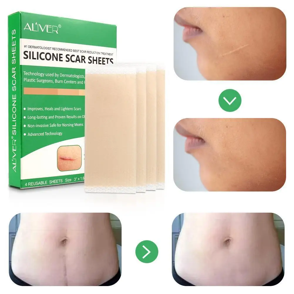 Aliver Medical Silicone Gel Strips Patch Scar Away Tape Treatment