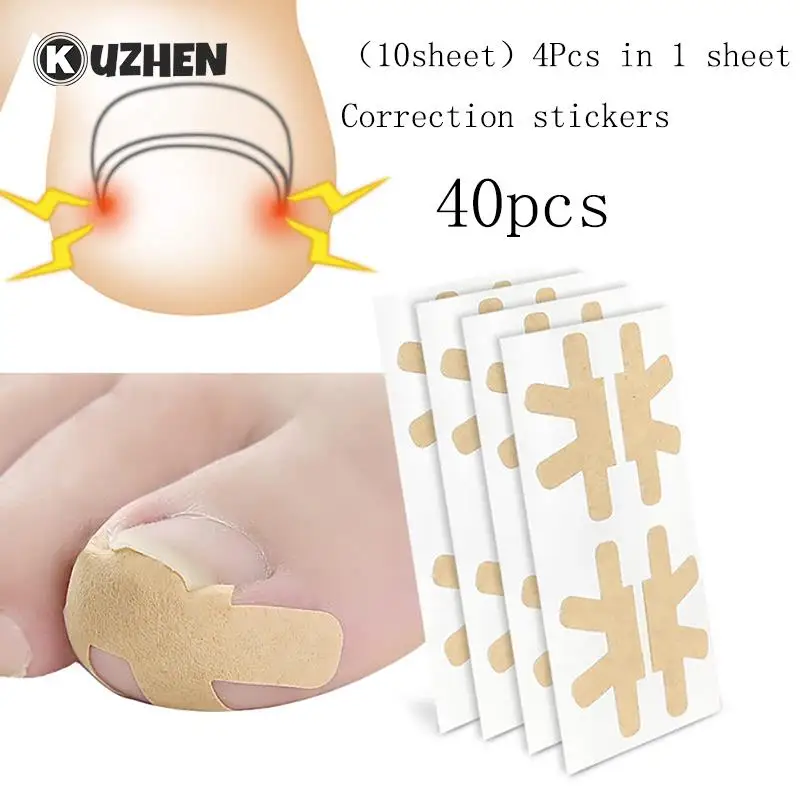 

40pcs Toe Nail Care Corrector Patch Paronychia Treatment Pedicure Correction Stickers Ingrown Toenail Corrector Stickers