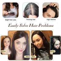 Silk Base Topper Europe Human Hair Toppers For Women Clip Ins Hair Extension Hair wigs Hairpiece Seamless Coverage Undetectable Toppers 6