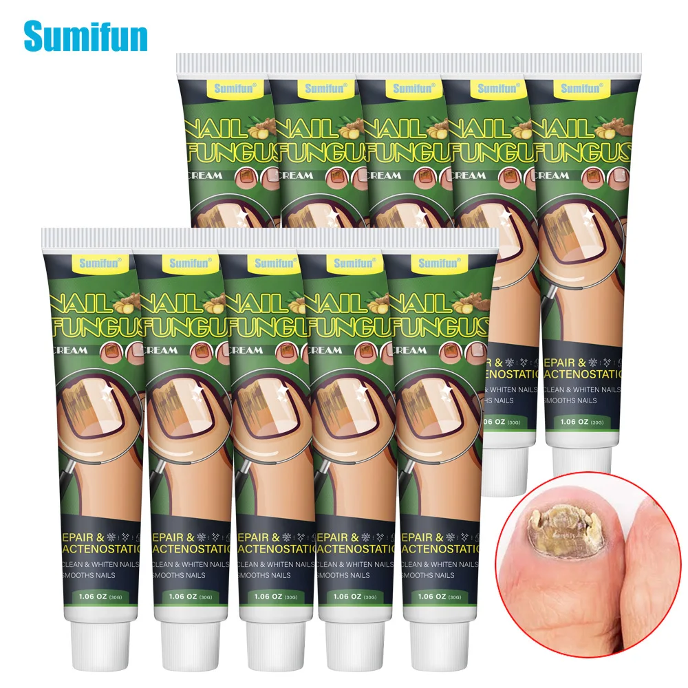 

1/3/6/10pcs Nail Fungus Care Ointment Treat Onychomycosis Toe Paronychia Antibacterial Cream Antifungal Repair Medical Plaster