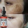 Niacinamide Facial Serum Salicylic Acid Moisturizing Skin Care Products 2024 1