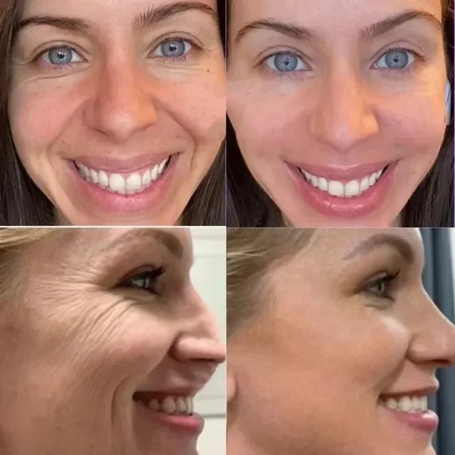 Crema antietà al veleno d'api Ringiovanisce la pelle del viso Idratazione profonda Dissolvenza Linee Assorbimento rapido Riparazione Rughe istantanee Cura della pelle 2