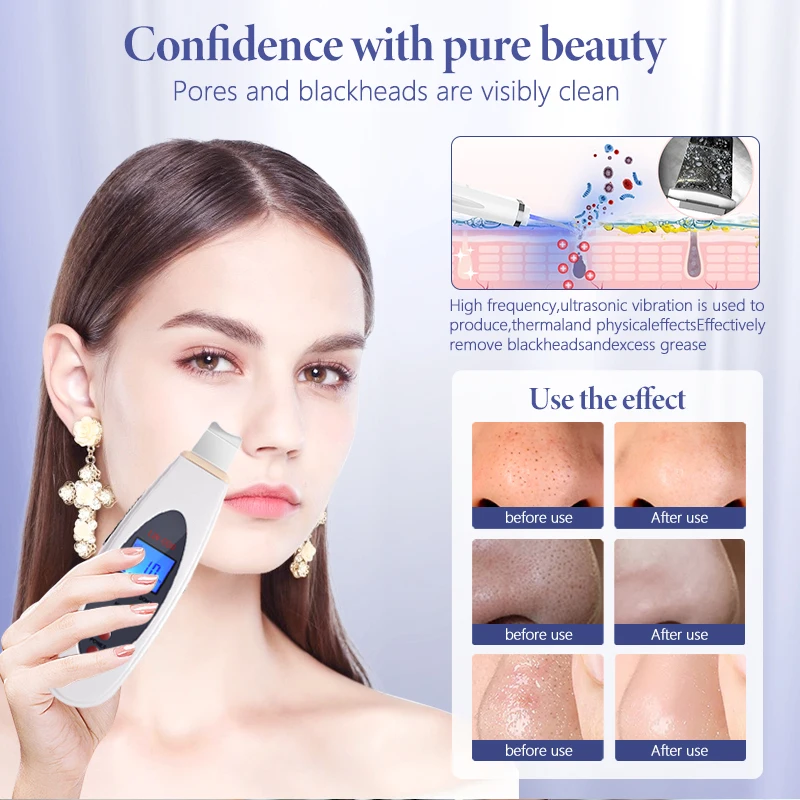 Ultrasonic Skin Deep Cleansing Machine Facial Acne Removal Facial Massage Keratin Blackhead Lifting Beauty Device