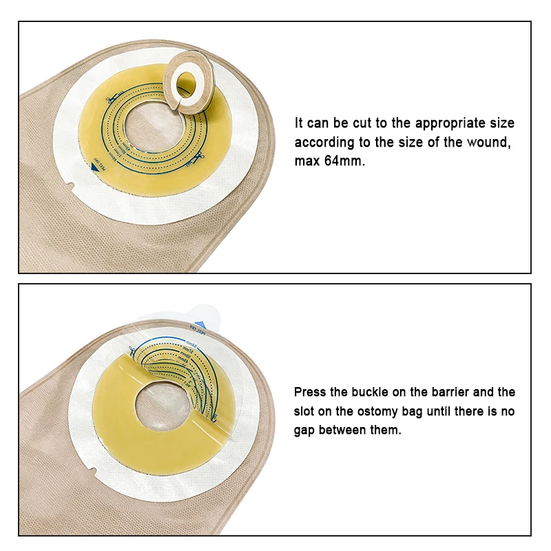 20pcs One Piece Colostomy Bags with Hoop and Look Ostomy Bags for Ostomy Patient 4