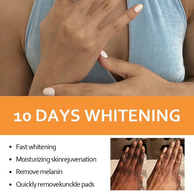 5D Gluta Szerves Vitamin E És Kollagén-Taches Hidratáló Test Csukló Fehérítő Szérum 125 Ml Sötét Foltokhoz - Image 3