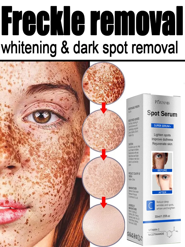 Esencia blanqueadora para eliminación de pecas, líquido descompone la melanina, desvanece las manchas oscuras, tratamiento de Melasma, ilumina el tono de la piel opaco, 377