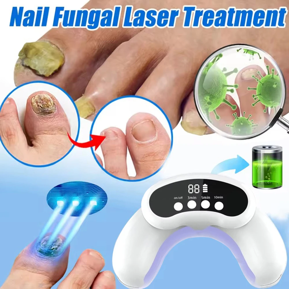 Nail Fungus Laser Treatment Device Fingernail Fungus Treat Onychomycosis Therapy Effectively Remove Onychomycosis Grow Toe Nail