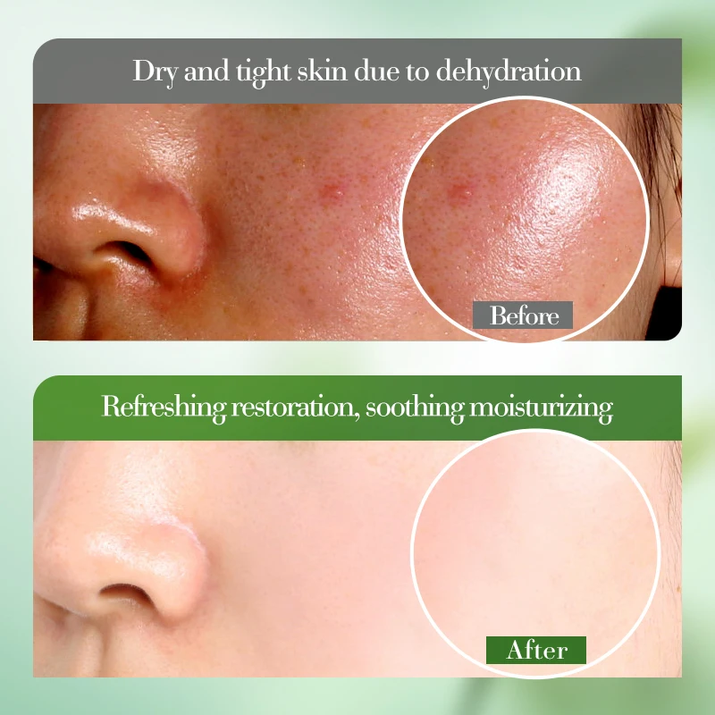 1/2/3 قطعة 50 مللي جل الصبار المرطب والمهدئ ترطيب...