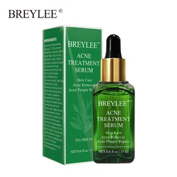 BREYLEE Face Care Acne Treatment Serum Facial Anti Acne Pimple Remove Freckle Speckle Essence Face Moisturizing Serum Skin Care