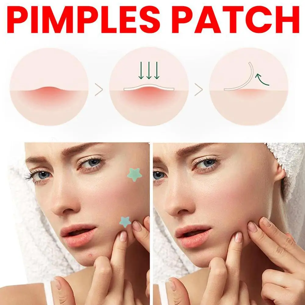 Invisible Acne Pimple Patch Waterproof Spot Treatment