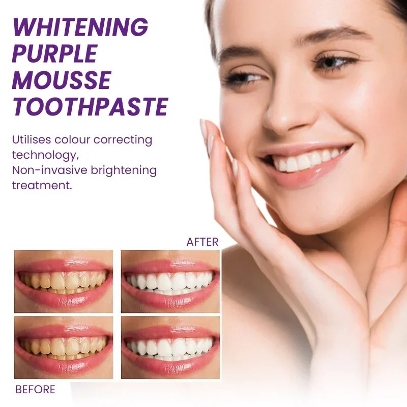 

SdatterWhitening Purple Mousse Toothpaste Cleaning Yellow Tooth Tartar Remove Cigarette Stains Teeth Anti-Cavity Oral Care Fresh