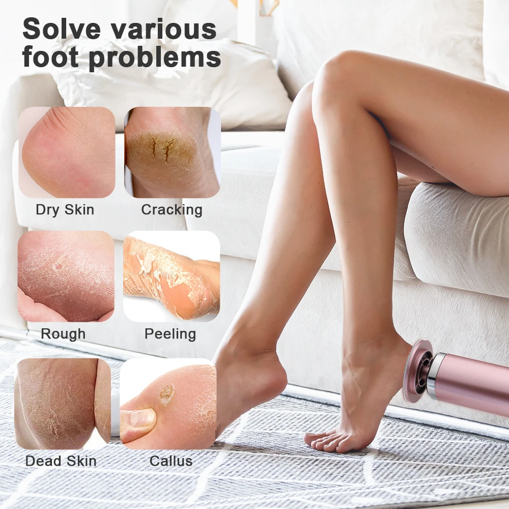 Wireless Rechargeable Electric Foot Grinder Feet Heel Dead Skin Callus Remover Foot Care File Professional Pedicure Tools
