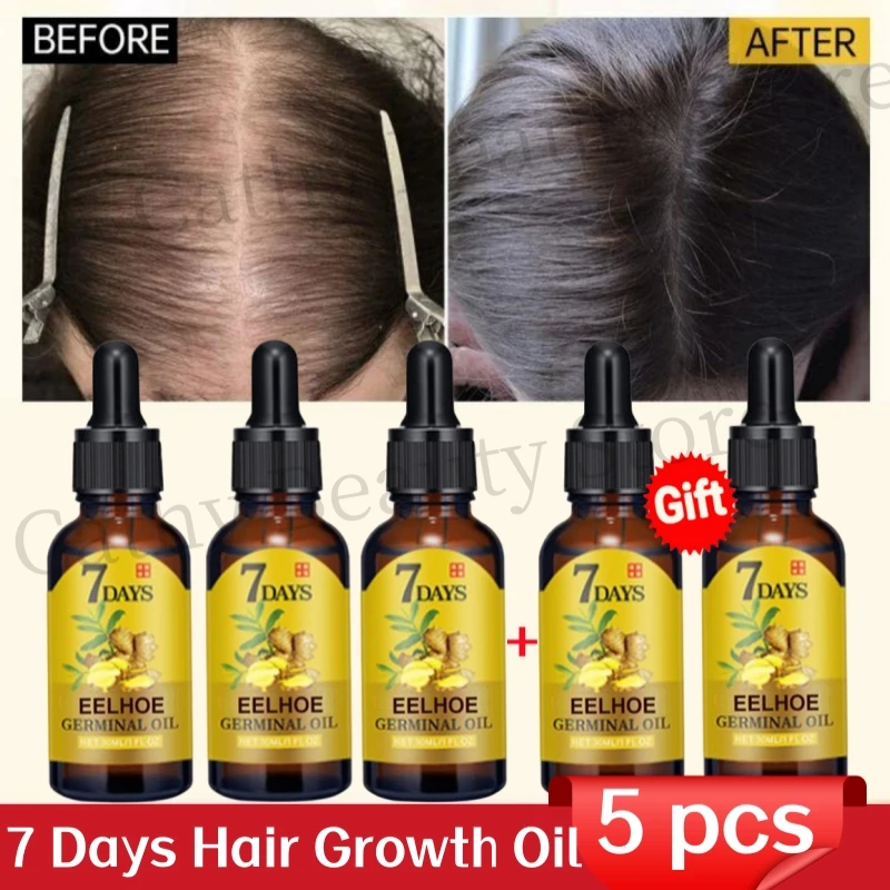 

Fast Hair Growth Serum Ginger Anti Hair Loss Men Women Scalp Treatment Oil Damaged Hair Roots Regrowth Nutrition Care Product