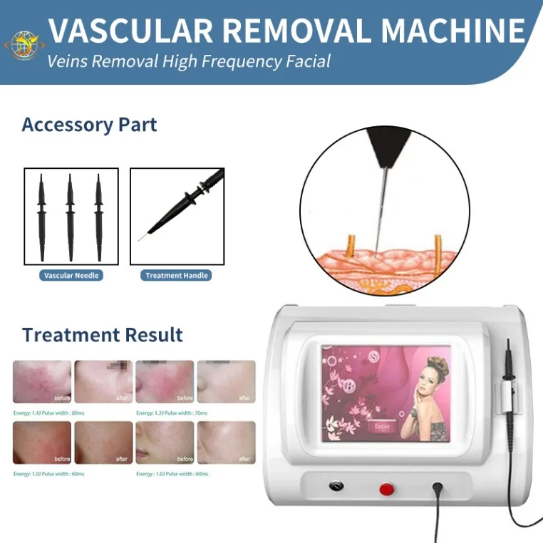 

Laser Machine Rbs Ultrasonic R-F Spider Vein Removal Vascular Removal High Frequency Machine