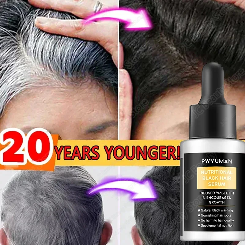

Gray White Hair Treatment Serum Hair Growth Oils White Black Natural Color Fast Regrowth Anti Hair Loss Beauty Health Women Men