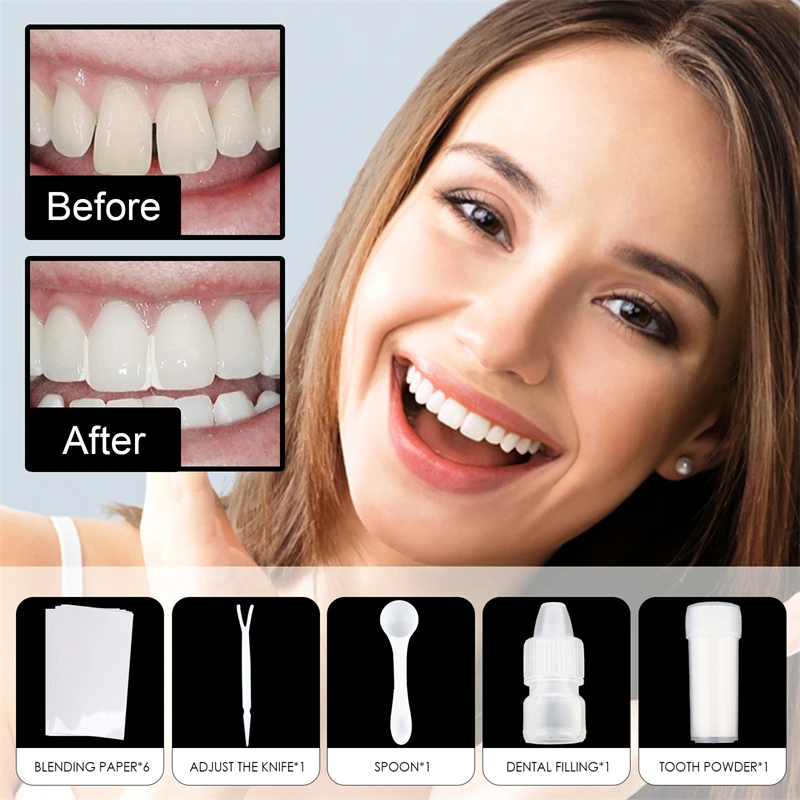 1PC Temporary Tooth Repair Kit False Teeth Solid Glue Denture for Missing  Broken Teeth Moldable Tooth Filling False Teeth Tool - AliExpress