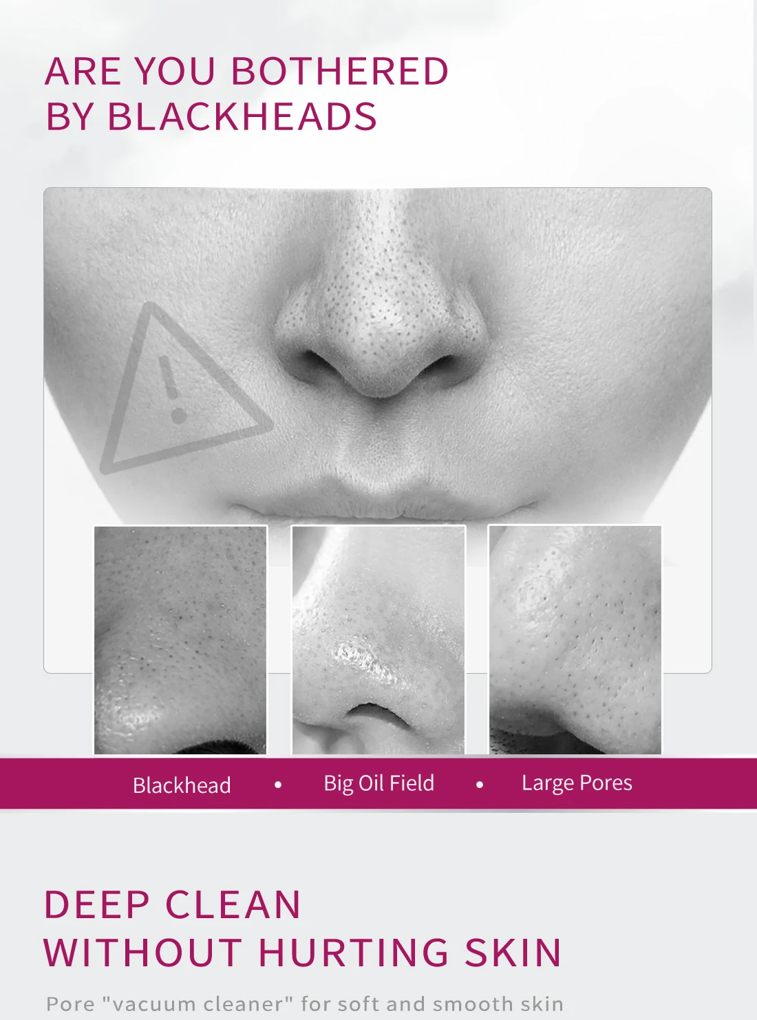 Description Picture 3 of itemRemoves Blackheads Deep Cleans Pores Softens Cuticles Absorbs Excess Oil and Dirt Mango Extract Safe and Natural  Shrink Pores