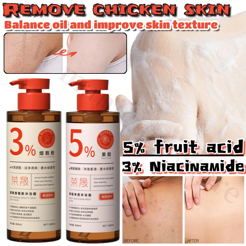 

Niacinamide Fruit Acid Shower Gel Removes Pore Dirt Exfoliates, Balances Oil Improves Skin Texture and Moisturizes Shower Gel