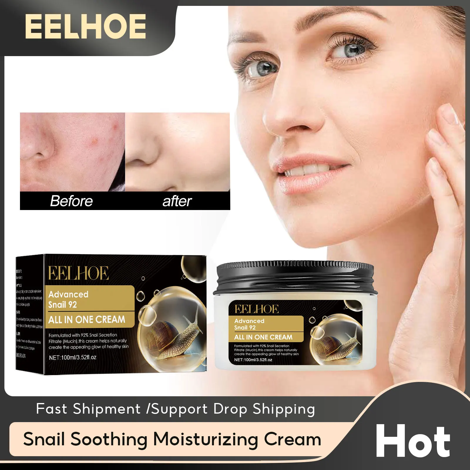 Acne Treatment Cream Shrinking Pores Fade Acne Marks Improve Roughness Whitening Moisturizing Firming Skin Snail 92 Repair Cream