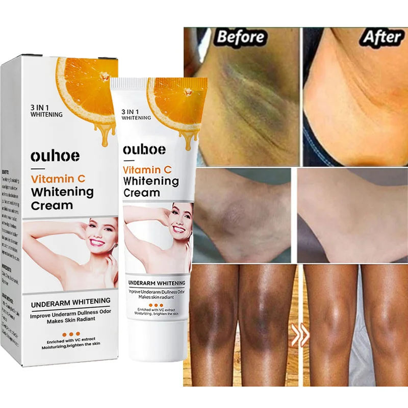 Vitamin C Body Whitening Cream Private Parts Underarm Legs Knees