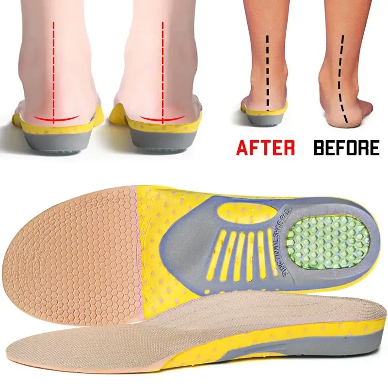 Orthotic Insoles 1/3Pairs Orthopedic Insoles Orthotics Flat Foot Health Sole Pad Arch Support Pad Plantar Fasciitis Feet Care