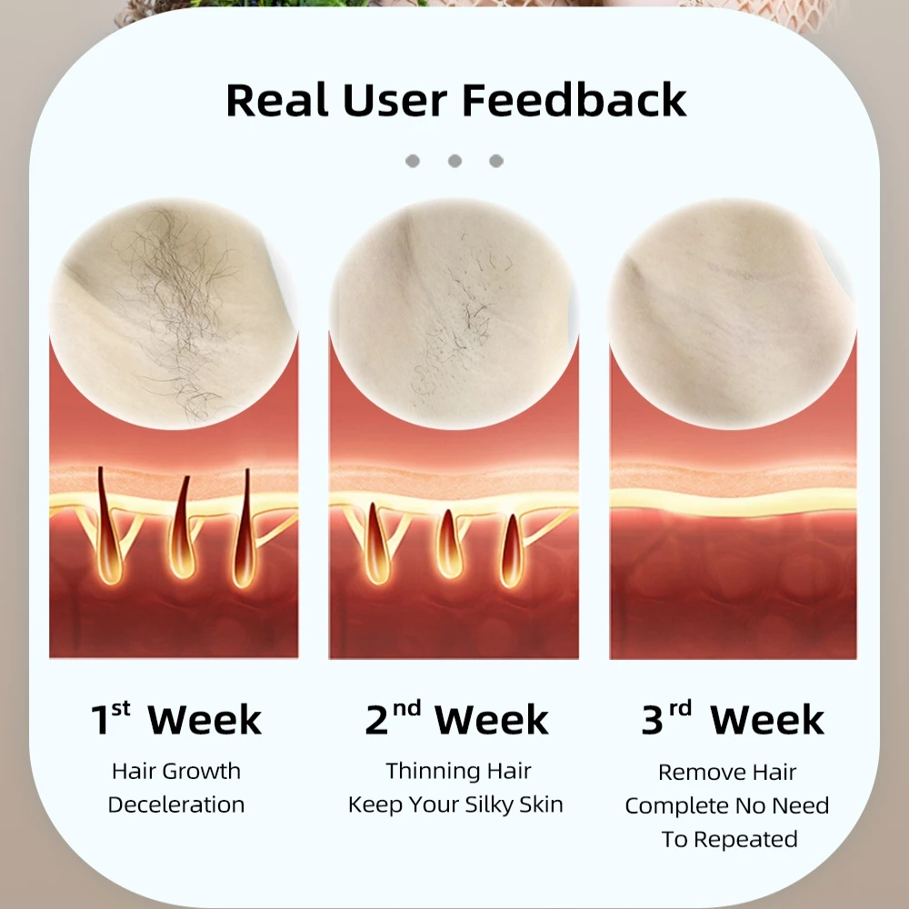 جهاز إزالة الشعر بالليزر MLAY T17 آلة إزالة الشعر...