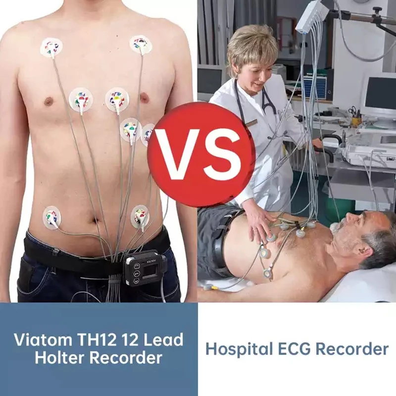 12 lead Holter monitor monitor recorder 24-hour continuous monitoring ECG and heart rate device ECG electrode data stora