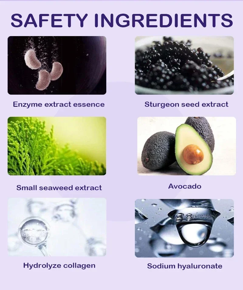 Ű ̽ ũ,  ǰ V ø, Ű ̽   ,    ũ